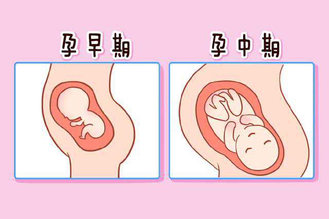 孕期＂上怀＂和＂下怀＂：哪种怀胎方式更适合你？