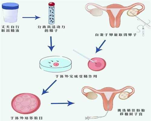 代孕小孩-哪些原因造成了男性精子成活率低-