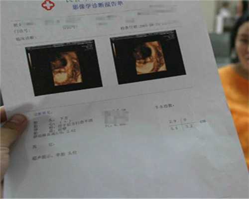 代孕包性别-输卵管有炎症怎么能治好-十月份喜孕