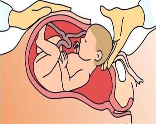成都代孕中介·哪里可以代孕·代孕期间，孕妈如