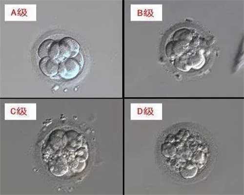 试管婴儿代孕网～第四代试管婴儿代孕～过年了